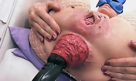 Most fearsome prolapse scene! cervix, fisting, max overstate